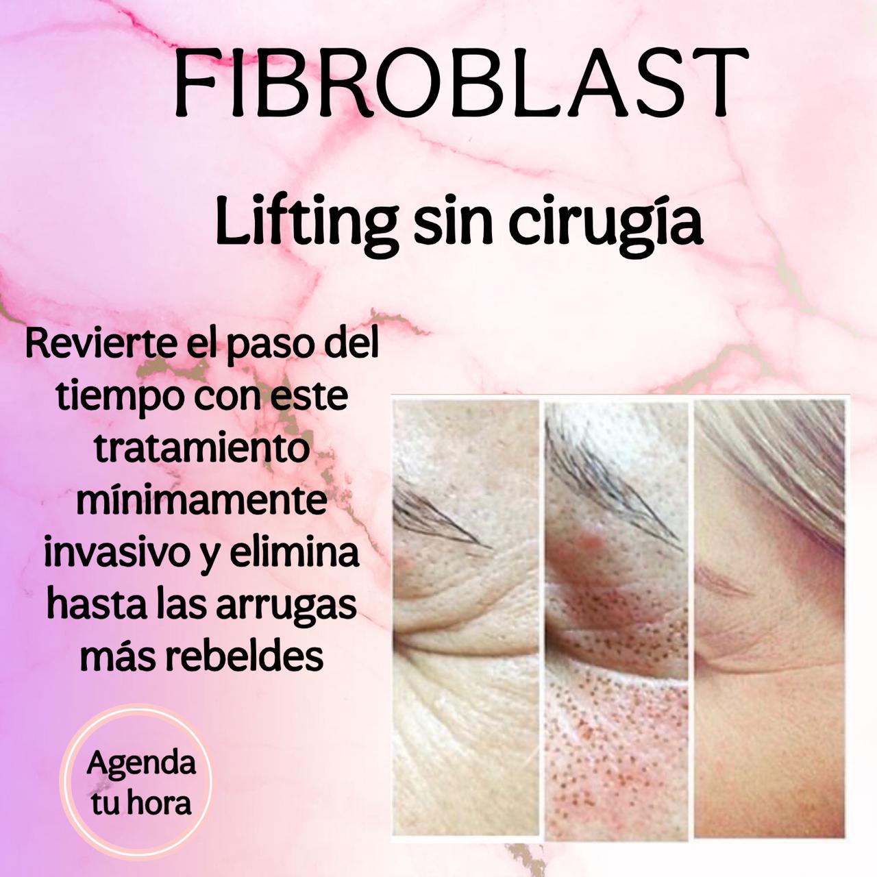 Tratamiento Fibroblast