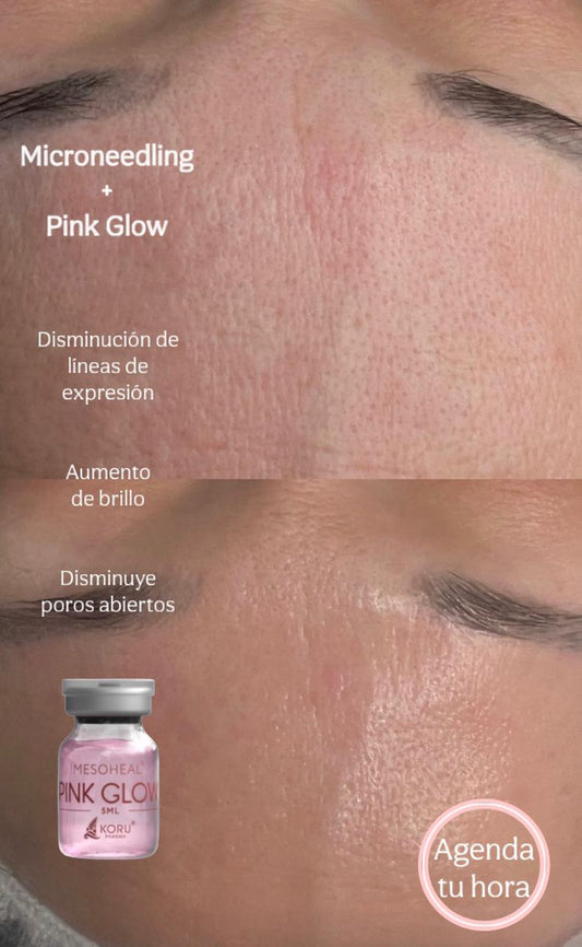 Tratamiento Pink Glow